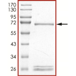 MET (Del Ex14), Active